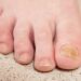 Why Are My Toenails Yellow? 9 Surprising Causes & Easy Fixes