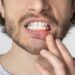 Why Is My Gum Swollen Around One Tooth in the Back? Causes & Quick Fixes