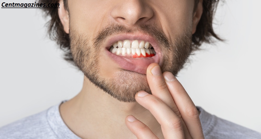 Why Is My Gum Swollen Around One Tooth in the Back? Causes & Quick Fixes