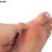 Why Does My Big Toe Hurt? 7 Common Causes You Shouldn’t Ignore