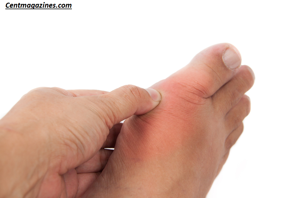 Why Does My Big Toe Hurt? 7 Common Causes You Shouldn’t Ignore