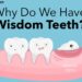 Why Do We Have Wisdom Teeth? The Truth Dentists Don’t Always Explain