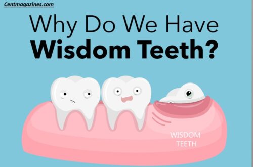 Why Are They Called Wisdom Teeth? The Surprising Truth Revealed