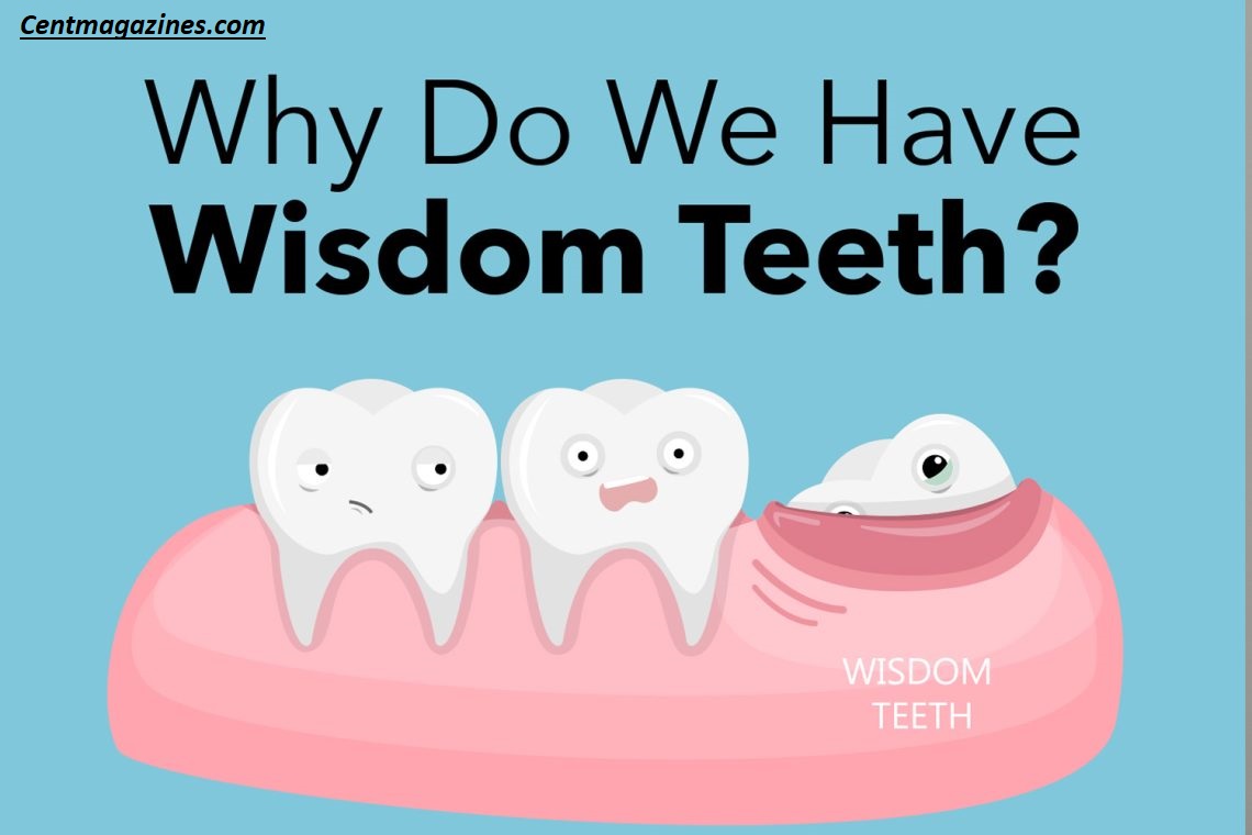 Why Are They Called Wisdom Teeth? The Surprising Truth Revealed