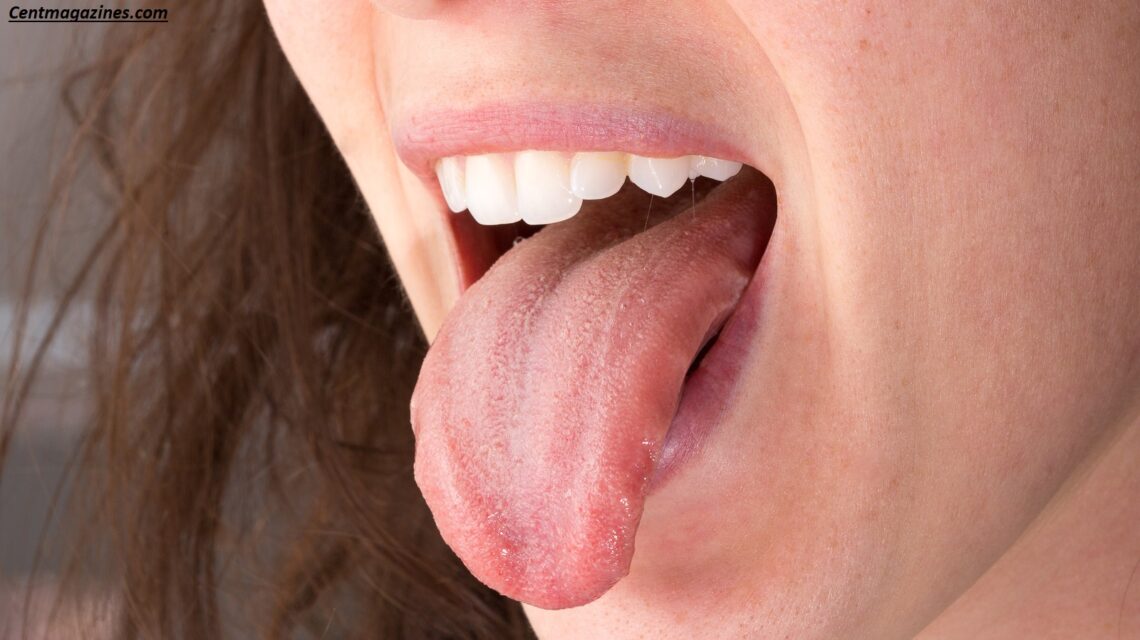 Why Does the Side of My Tongue Hurt? 7 Surprising Causes You Shouldn’t Ignore