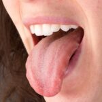Why Does the Side of My Tongue Hurt? 7 Surprising Causes You Shouldn’t Ignore