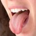 Why Does the Side of My Tongue Hurt? 7 Surprising Causes You Shouldn’t Ignore