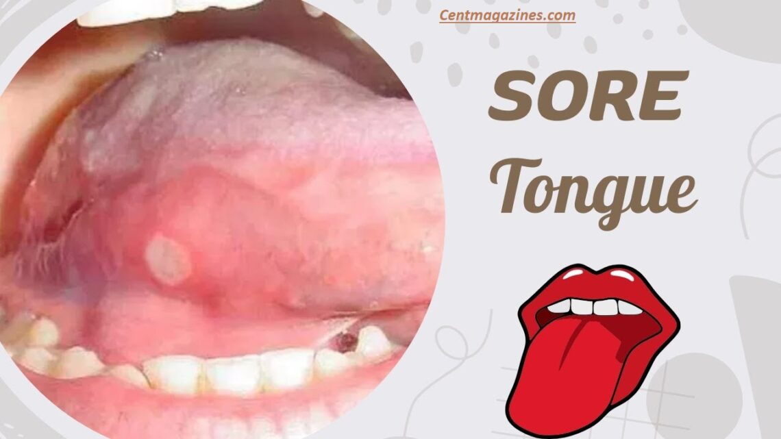 Why Is My Tongue Sore All of a Sudden? Real Causes & Fixes