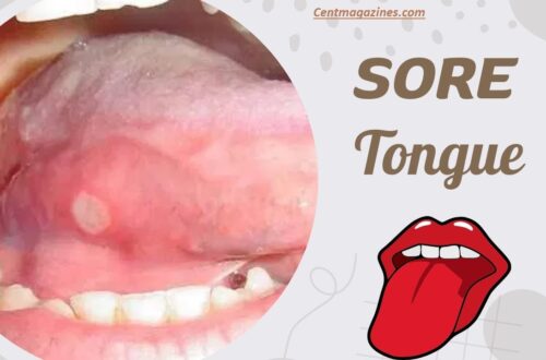 Why Is My Tongue Sore All of a Sudden? Real Causes & Fixes