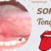 Why Is My Tongue Sore All of a Sudden? Real Causes & Fixes