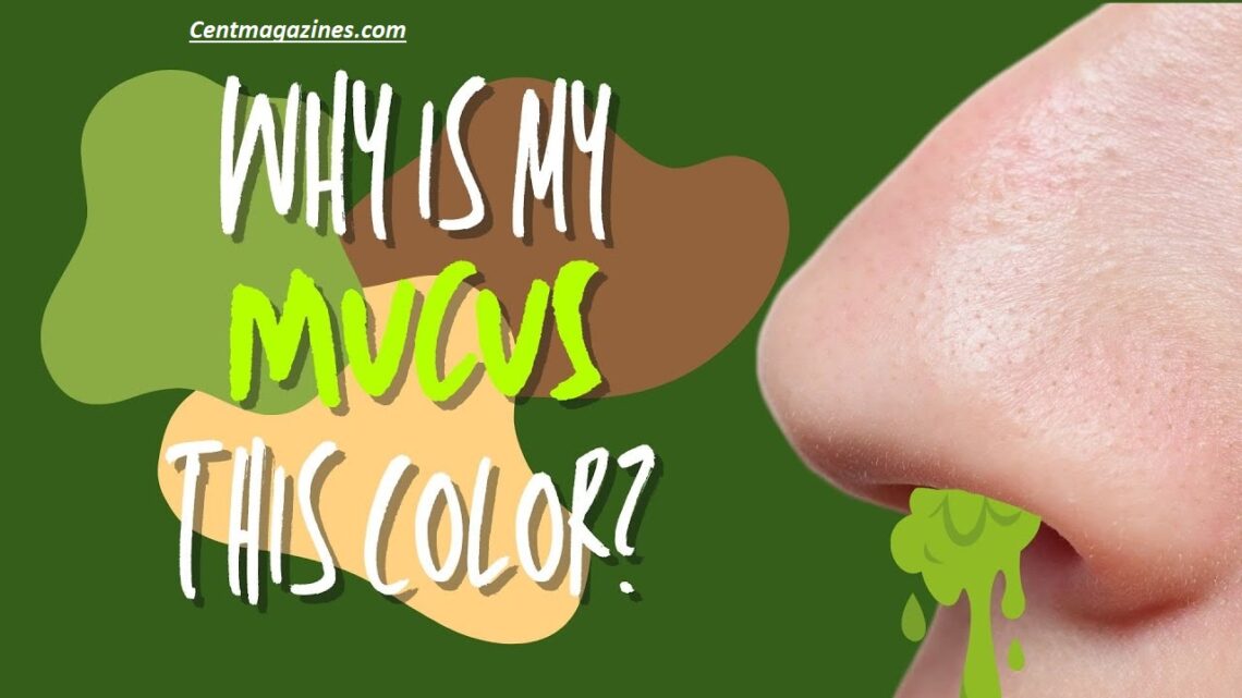 Why Is My Snot Yellow? 7 Reasons You Shouldn’t Ignore