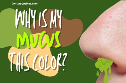 Why Is My Snot Yellow? 7 Reasons You Shouldn’t Ignore