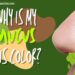 Why Is My Snot Yellow? 7 Reasons You Shouldn’t Ignore