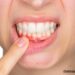 Why Is My Gum Swollen Around One Tooth? Causes You Shouldn’t Ignore