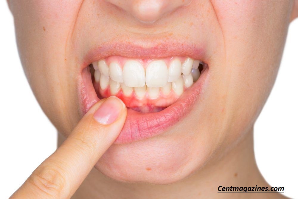 Why Is My Gum Swollen Around One Tooth? Causes You Shouldn’t Ignore