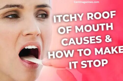 Why Is the Roof of My Mouth Itchy? Here's What's Actually Going On