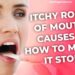 Why Is the Roof of My Mouth Itchy? Here's What's Actually Going On